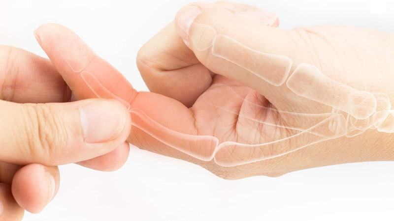 đau khớp ngón tay là bệnh gì 