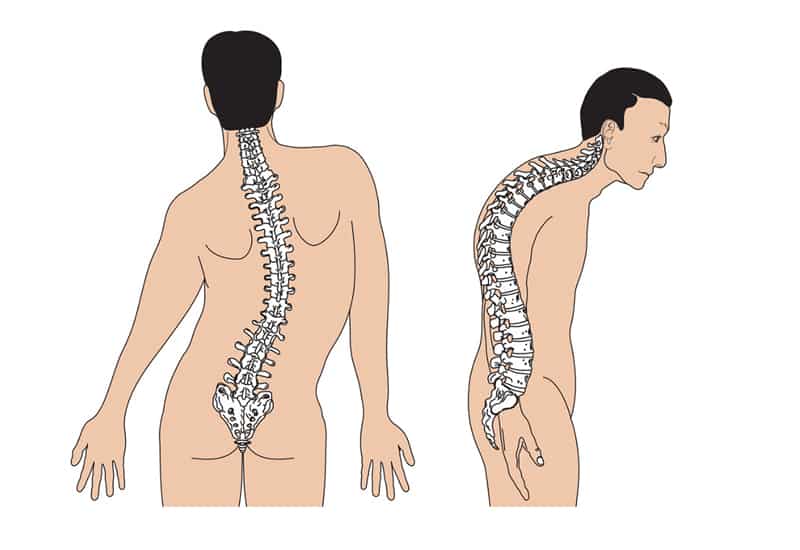 cách trị đau thắt lưng 